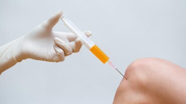 PRP THERAPY OSTEOARTHRITIS KNEE