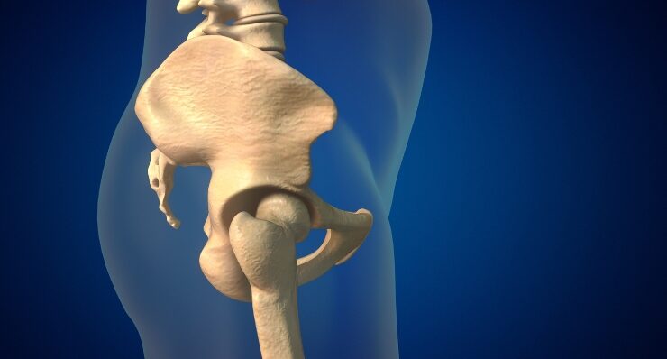 Specialized Pelviacetabular Surgery by Dr. Nikhil S. Charde